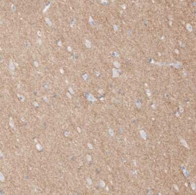 Immunohistochemistry-Paraffin: L1CAM Antibody [NBP1-86544]