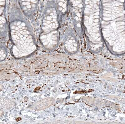 Immunohistochemistry-Paraffin: L1CAM Antibody [NBP1-86544]