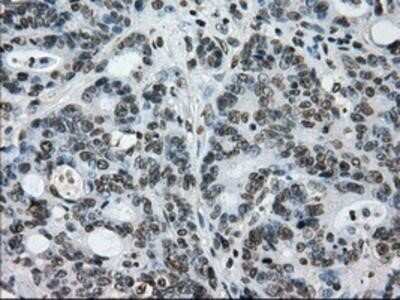Immunohistochemistry: L1CAM Antibody (OTI2A6) - Azide and BSA Free [NBP2-71097]