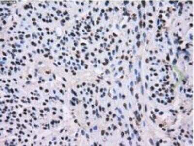 Immunohistochemistry: L1CAM Antibody (OTI2A6) - Azide and BSA Free [NBP2-71097]