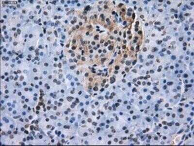 Immunohistochemistry: L1CAM Antibody (OTI2A6) - Azide and BSA Free [NBP2-71097]