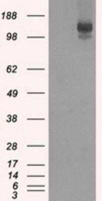 Western Blot: L1CAM Antibody (OTI2A6)Azide and BSA Free [NBP2-71097]