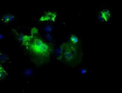 Immunocytochemistry/ Immunofluorescence: L1CAM Antibody (OTI2A6) [NBP2-02149]