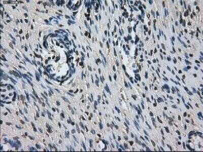 Immunohistochemistry-Paraffin: L1CAM Antibody (OTI2A6) [NBP2-02149]