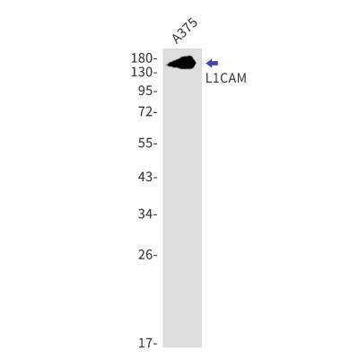 Western Blot: L1CAM Antibody (S04-8I3) [NBP3-20043]