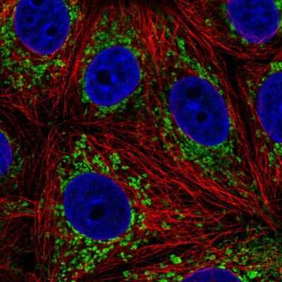 Immunocytochemistry/ Immunofluorescence: L2HGDH Antibody [NBP2-49445]