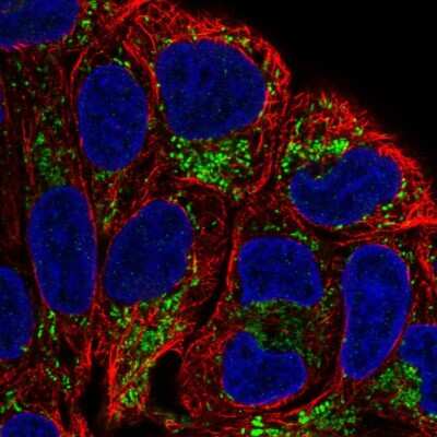 Immunocytochemistry/ Immunofluorescence: L2HGDH Antibody [NBP2-57724]
