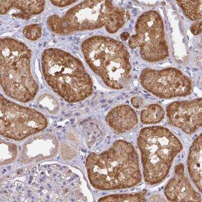 Immunohistochemistry-Paraffin: L3HYPDH Antibody [NBP2-31648]