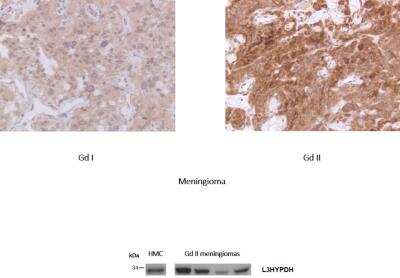 Immunohistochemistry-Paraffin: L3HYPDH Antibody [NBP2-31648]