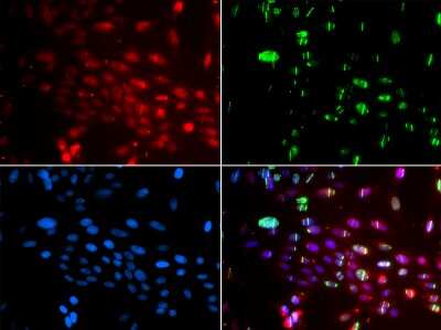 Immunocytochemistry/ Immunofluorescence: L3MBTL1 Antibody - BSA Free [NBP3-05093]