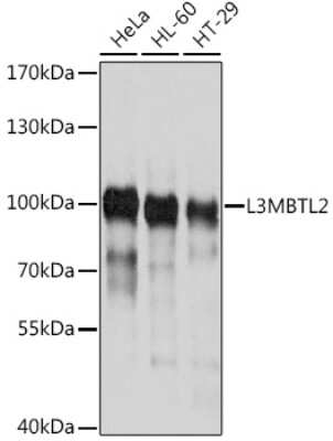Western Blot: L3MBTL2 AntibodyBSA Free [NBP3-05067]