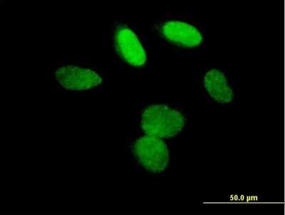 Immunocytochemistry/ Immunofluorescence: L3MBTL3 Antibody [H00084456-B01P]