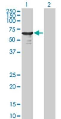 Western Blot: L3MBTL4 Antibody (1B9-1C12) [H00091133-M01]