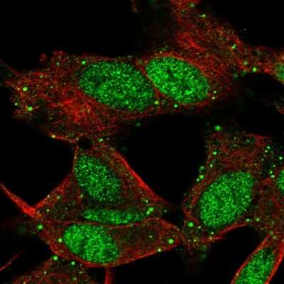 Immunocytochemistry/ Immunofluorescence: L3MBTL4 Antibody [NBP2-56598]