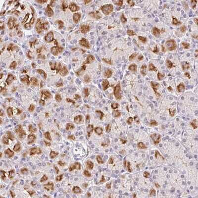 Immunohistochemistry: L3MBTL4 Antibody [NBP2-39018]