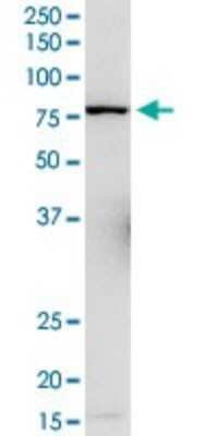 Western Blot: L3MBTL4 Antibody [H00091133-D01P]
