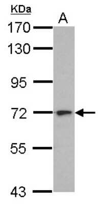 Western Blot: L3MBTL4 Antibody [NBP2-15009]
