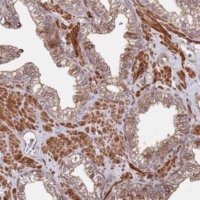 Immunohistochemistry-Paraffin: LACC1 Antibody [NBP1-92062]