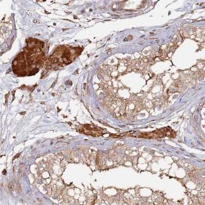 Immunohistochemistry-Paraffin: LACC1 Antibody [NBP1-92062]