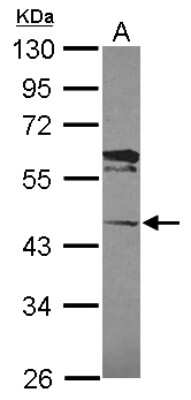 Western Blot: LACC1 Antibody [NBP2-19318]