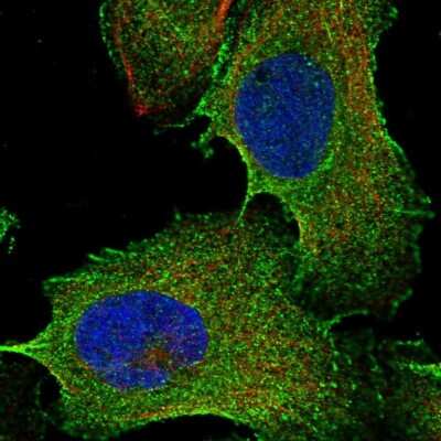 Immunocytochemistry/ Immunofluorescence: LACE1 Antibody [NBP1-89217]