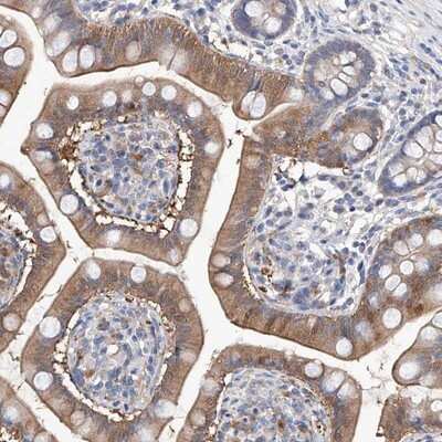 Immunohistochemistry-Paraffin: LACE1 Antibody [NBP1-89217]