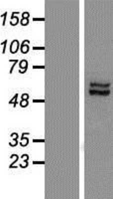 Western Blot: LACE1 Overexpression Lysate [NBP2-05487]