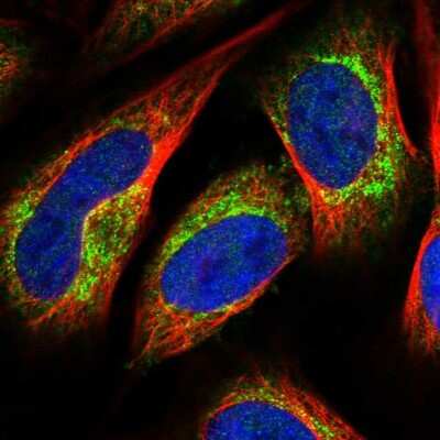 Immunocytochemistry/ Immunofluorescence: LACTB Antibody [NBP1-91701]