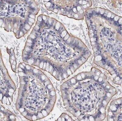 Immunohistochemistry-Paraffin: LAD1 Antibody [NBP1-85945]