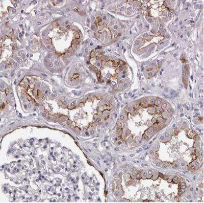 Immunohistochemistry-Paraffin: LAD1 Antibody [NBP1-85945]