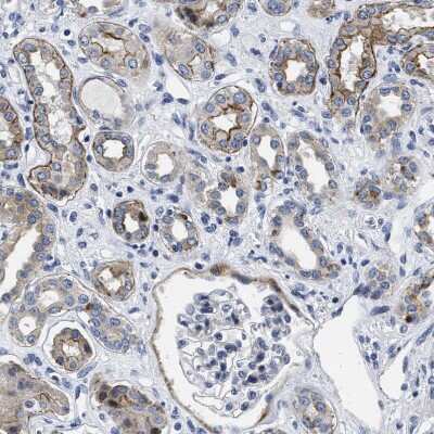 Immunohistochemistry-Paraffin: LAD1 Antibody [NBP1-86126]