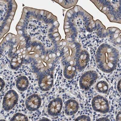 Immunohistochemistry-Paraffin: LAD1 Antibody [NBP1-86126]