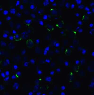 Immunocytochemistry/ Immunofluorescence: LAG-3 Antibody (1C6) - VHH - Azide and BSA Free [NBP3-12839]