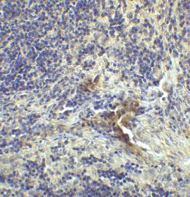 Immunohistochemistry: LAG-3 Antibody (1C6) - VHH - Azide and BSA Free [NBP3-12839]