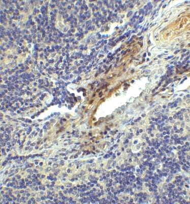 Immunohistochemistry: LAG-3 Antibody (2A11) - VHH - Azide and BSA Free [NBP3-12836]