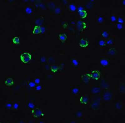 Immunocytochemistry/ Immunofluorescence: LAG-3 Antibody (2B11) - VHH - Azide and BSA Free [NBP3-12838]