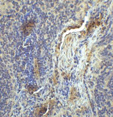 Immunohistochemistry: LAG-3 Antibody (2B11) - VHH - Azide and BSA Free [NBP3-12838]