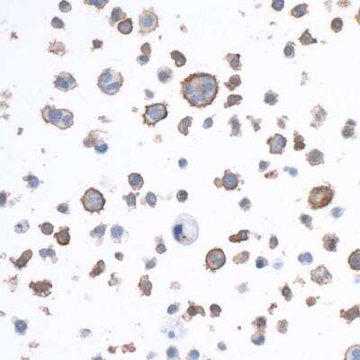 Immunocytochemistry/ Immunofluorescence: LAG-3 Antibody (BLR027F) [NBP2-76402]