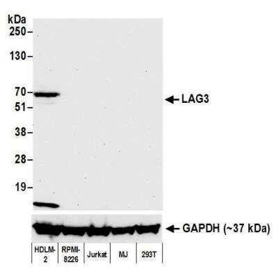 Western Blot: LAG-3 Antibody (BLR027F) [NBP2-76402]