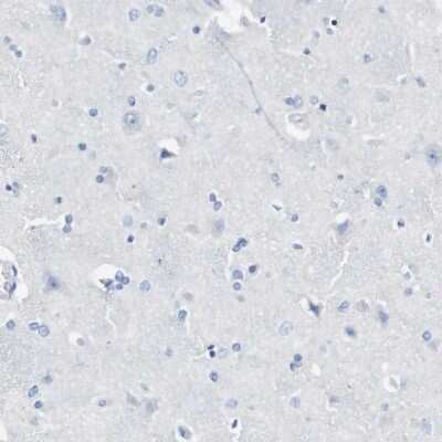 Immunohistochemistry-Paraffin: LAG-3 Antibody [NBP1-85781]