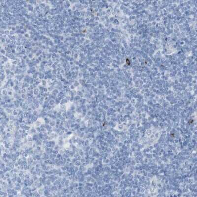 Immunohistochemistry-Paraffin: LAG-3 Antibody [NBP1-85781]