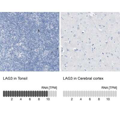 Immunohistochemistry-Paraffin: LAG-3 Antibody [NBP1-85781]