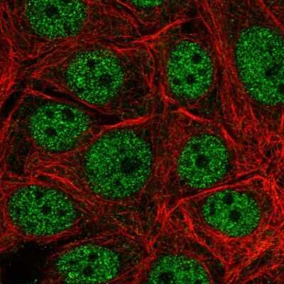 Immunocytochemistry/ Immunofluorescence: LAGE3 Antibody [NBP2-32715]