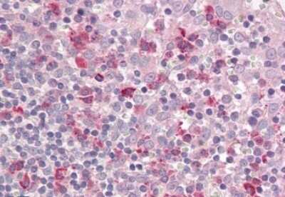 Immunohistochemistry-Paraffin: LAIR1 Antibody [NBP1-68845]