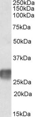 Western Blot: LAIR1 Antibody [NBP1-52010]