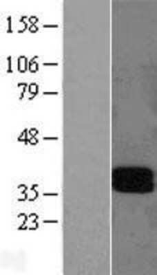 Western Blot: LAIR1 Overexpression Lysate [NBL1-12426]