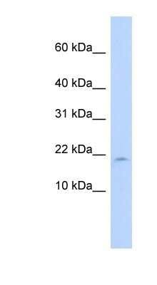Western Blot: LAIR2 Antibody [NBP1-80500]