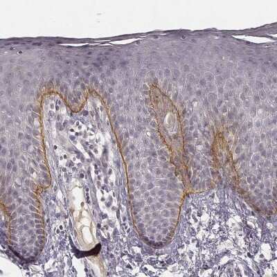 Immunohistochemistry-Paraffin: LAMC2 Antibody (CL2980) [NBP2-42388]