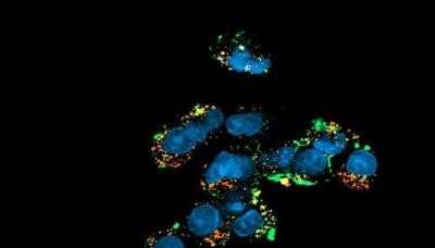 Immunocytochemistry/ Immunofluorescence: LAMP-1/CD107a Antibody (5E7) - Azide and BSA Free [NBP2-80824]