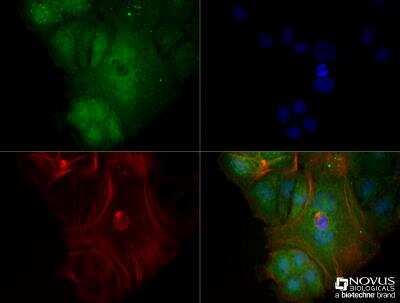 Immunocytochemistry/ Immunofluorescence: LAMP-1/CD107a Antibody (5E7) - BSA Free [NBP2-52721]